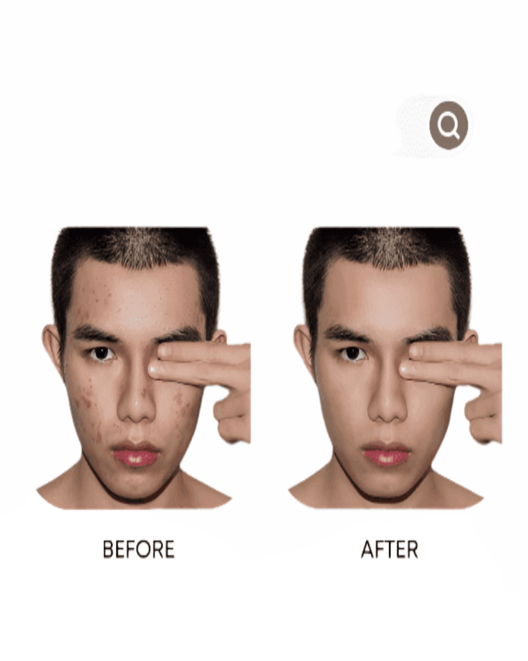 Anti-Acne Organic Facial Wash - For MEN-1